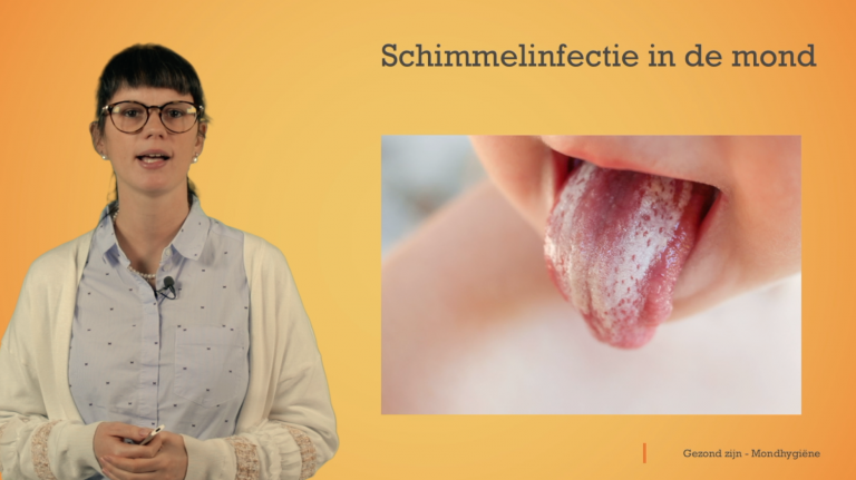 Mondhygiëne: infecties in de mond